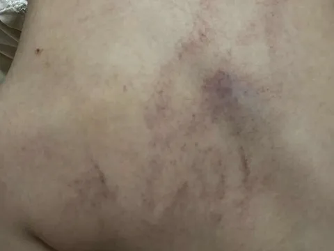 Vụ bé gái 4 tuổi bị đánh, ném vào tường ở Hà Nội: Cô giáo bạo hành nói gì?