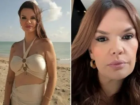 Danh tính nữ doanh nhân tử vong sau khi chọn thẩm mỹ "3 trong 1": Người chồng tiết lộ điều đau lòng