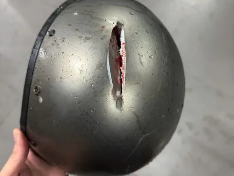 Thương tâm thanh niên bị kính rơi, đâm xuyên mũ bảo hiểm, vỡ sọ