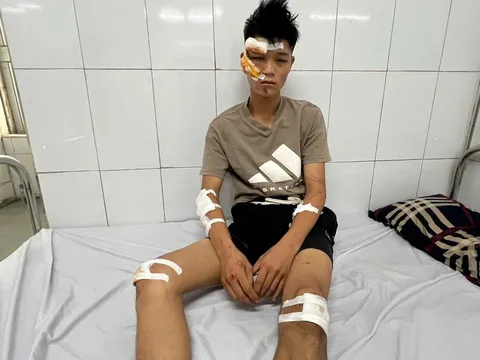 Lời khai gây phẫn nộ của "quái xế" đâm cảnh sát cơ động chấn thương sọ não: Lỗi chồng lỗi sẽ chịu hình phạt thế nào?