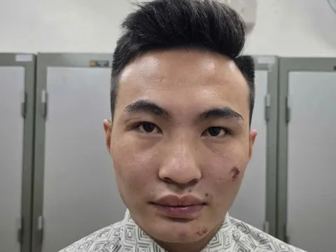 Danh tính kẻ say xỉn thông chốt bảo vệ A80, tông ngã công an phường