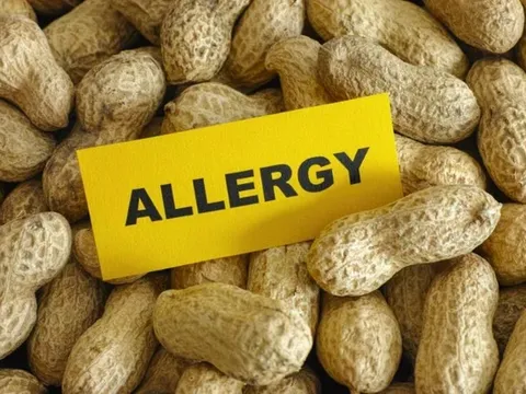 Nữ sinh đại học 19 tuổi tử vong sau khi ăn bánh ngọt: Tiết lộ về chiếc bánh được tặng bởi nhóm phụ nữ