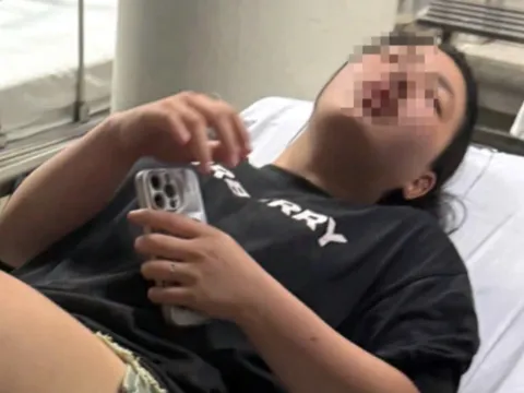 "Sẽ còn tìm đánh lần nữa"- câu nói khiến cô gái 19 tuổi ở Hà Nội sốc và sống trong sợ hãi sau khi bị đánh "thập tử nhất sinh"