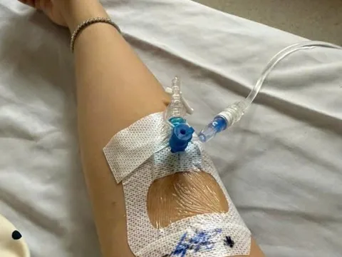 Nhiều cư dân tại chung cư ở TPHCM nhập viện sau khi ăn bánh mì: Chủ tiệm bánh mì que lên tiếng nói ngay điều này