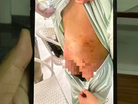 Mẹ ruột 25 tuổi cùng bạn trai 19 tuổi bạo hành bé gái 9 tuổi: Lời khai gây phẫn nộ