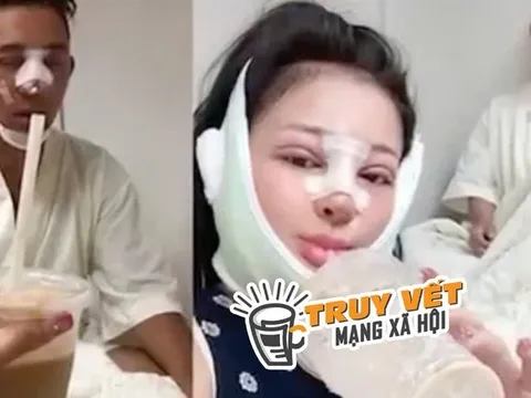 Bác sĩ Chiêm Quốc Thái nói gì về chiếc mũi biến dạng của Ngân 98?