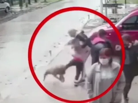 Bé gái 7 tuổi bị chó pitbull tấn công giữa phố, người chứng kiến nói điều đau lòng