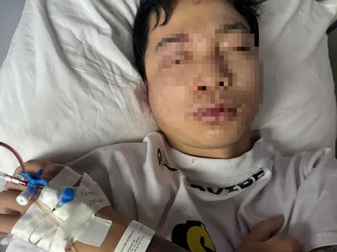Nam DJ trẻ bị hành hung ở Huế phải nhập viện điều trị: Công an đang trích xuất camera