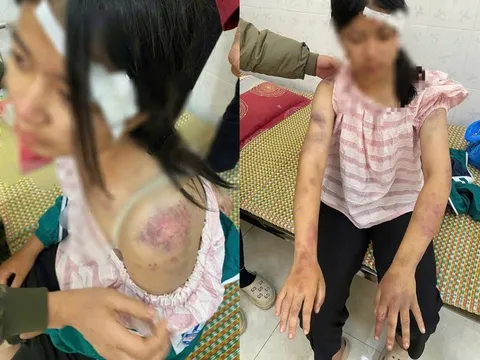 Khởi tố bà nội và 2 ông bạo hành bé gái 13 tuổi ở Thái Nguyên