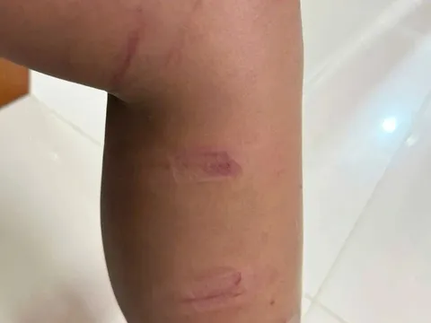 Danh tính người đàn ông đẩy ngã xe, đánh 3 cháu bé ở Quảng Ngãi: Lời khai gây sốc