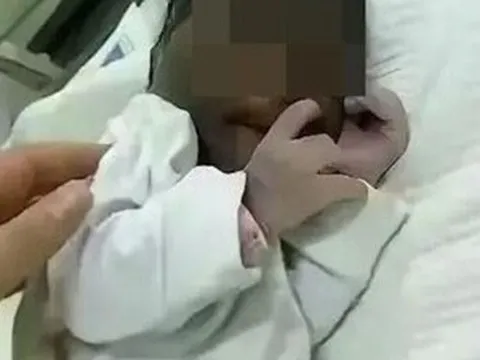 Con chào đời da đen như mực, khác hẳn bố mẹ, bác sĩ nói nguyên nhân khiến gia đình hoang mang