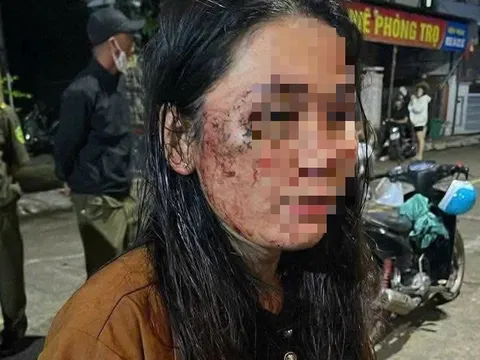 Nữ shipper tố bị khách hàng hành hung vì không cho trả hàng: Hé lộ về cuộc "đôi co" thổi bùng giận dữ