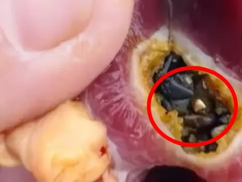 Mổ bụng vịt, sững sờ phát hiện vàng trong dạ dày