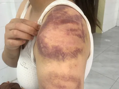 4 lần hành hạ vợ mang thai và con gái trong 4 ngày, Phan Văn Minh bị bắt tạm giam