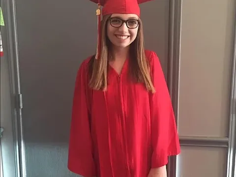 Cô gái bị chó cắn hủy hoại khuôn mặt lột xác sau 28 ca phẫu thuật