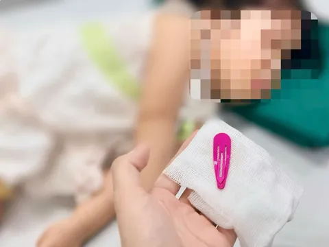 Bé gái 21 tháng tuổi nguy kịch vì thứ vô cùng quen thuộc mà nhà nào có con gái đều không thể thiếu