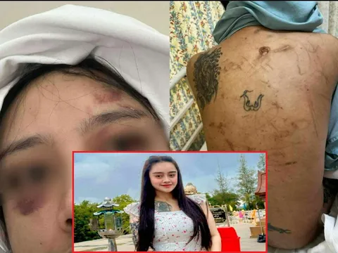 Cô gái bị bạo hành sau khi bỏ nhà đi gặp bạn trai, cha mẹ xót xa khi thấy điều này
