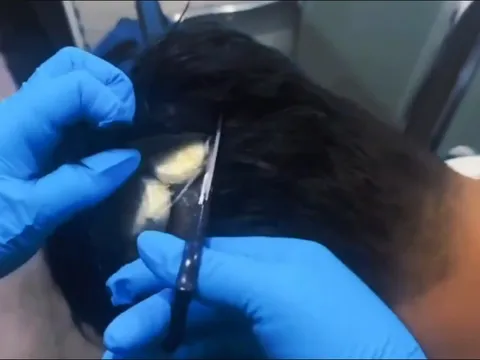Clip: Cảnh sát "cạy" tóc người đàn ông lên, bất ngờ phát hiện hơn 10.000 USD ma túy