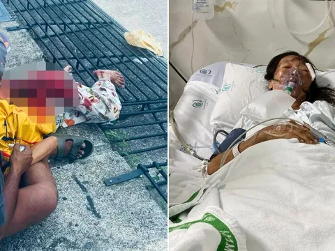 Thái Lan: Người phụ nữ mất tay sau khi vướng áo vào bánh xe