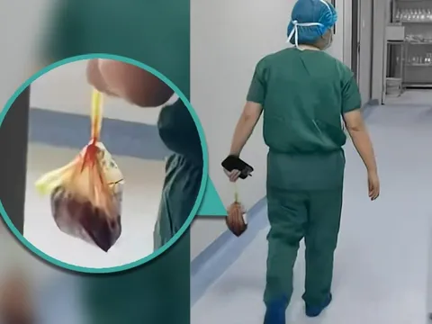 Bác sĩ Trung Quốc mất việc vì lén trộm nhau thai: Bí mật kinh hoàng đằng sau phòng mổ