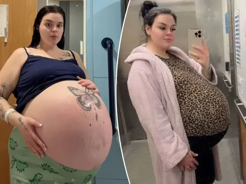 Bụng bầu to bất thường "như 1 căn penthouse”, mẹ trẻ suýt mất con vì biến chứng khó lường