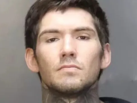 Nói nhiều, người phụ nữ bị bạn trai hắt nước sôi vào người