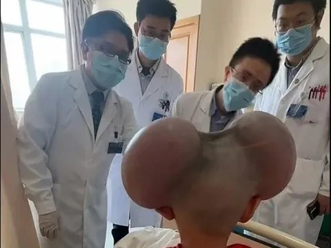 Bé trai bị trêu là ‘Mickey Mouse’ vì khối u ở đầu, hồi phục thần kỳ sau ca phẫu thuật dài 6 tiếng