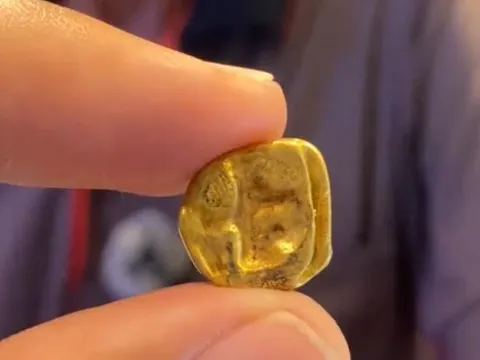 Thu gom răng vàng từ tro cốt, nhân viên mai táng làm điều này khiến nhiều người cảm động