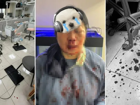 Chỉ vì “lấy cao răng quá đau”, nữ nha sĩ bị bệnh nhân đánh trọng thương, suýt mù mắt