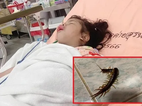 Bị rết cắn vào miệng khi ngủ, bé gái 3 tuổi phải nhập viện khẩn cấp
