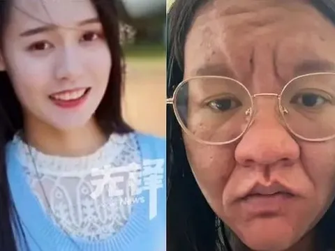 Mặt biến dạng, tóc rụng, da nám: Người mẹ trẻ kể chuyện vượt cạn khiến ai cũng cảm phục