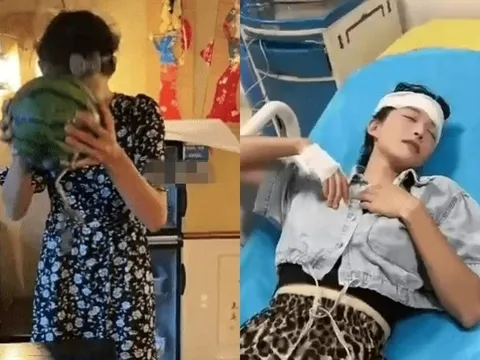 “Thiết đầu công” đời thực: Cô gái nhập viện vì chấn động não sau màn bổ dưa hấu bằng đầu