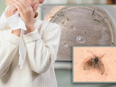 Bé gái 8 tuổi nôn ra giòi sống suốt cả tháng, nguyên nhân khiến ai cũng rùng mình