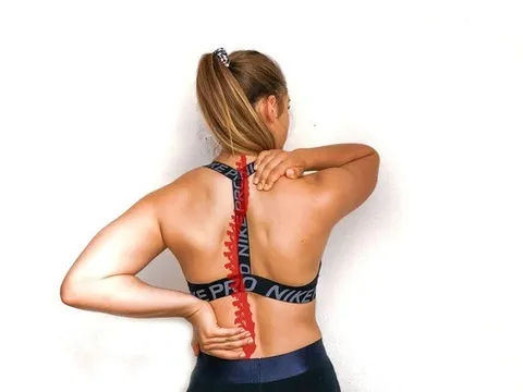 Tập gym đều mà vai lệch, lưng cong: Bạn có đang bỏ qua điều gì?