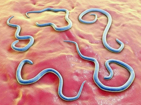 Rùng mình phát hiện giun đũa chó mèo ẩn trong mắt cụ bà suốt 20 ngày