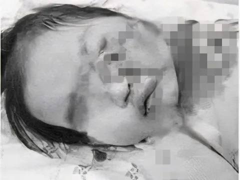 Mẹ vừa xuống xe, bé gái 2 tuổi vô tình vặn ga khiến xe lao thẳng vào hàng rào sắt, nhập viện trong tình trạng đa chấn thương