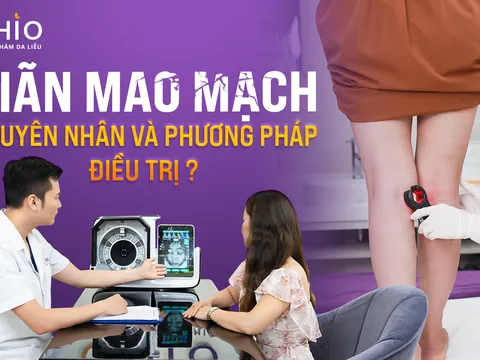 Giãn mao mạch: Nguyên nhân và phương pháp điều trị?