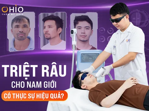 Triệt râu, Triệt lông cho Nam có thực sự hiệu quả?