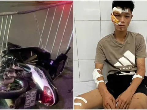 Trao tặng bằng khen ghi nhận tinh thần “vì nước quên thân, vì dân phục vụ” cho đại úy bị thương khi ngăn quái xế 'thông chốt' bảo vệ hợp luyện A80