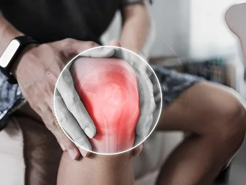 Các nhà khoa học Nga cảnh báo nguy cơ hoại tử xương ở bệnh nhân hậu COVID-19