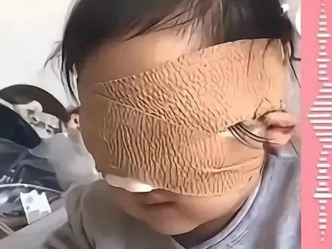 Cả nhà chết lặng khi bé gái 6 tuổi bị mù cả hai mắt chỉ vì thói quen này, nhiều đứa trẻ khác cũng đang mắc phải
