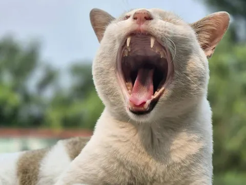 Người phụ nữ ngáp gãy cả cổ