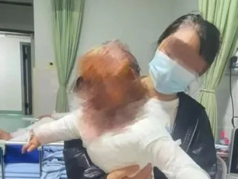 Chỉ vì chiếc bình đun nước trong bếp, bé trai 1 tuổi phải nhập viện vì bỏng 40% cơ thể khiến cha mẹ hoảng loạn