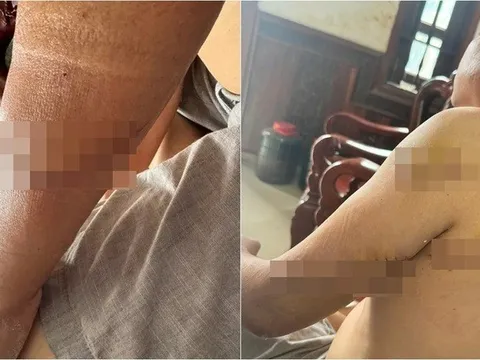 Bắt giữ 3 nghi phạm truy sát người đàn ông ở Đồng Nai