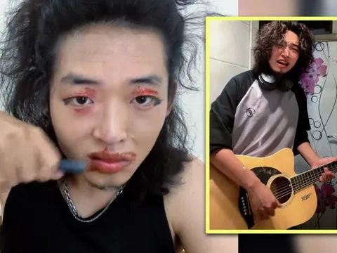 Cánh tay run rẩy từng khiến chàng trai này tự ti, giờ trở thành “vũ khí” lan tỏa tinh thần lạc quan đến với hàng trăm nghìn người hâm mộ