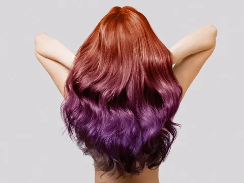 Nhuộm tóc mỗi tháng để giống idol, cô gái 20 tuổi trả giá đắt khi mắc căn bệnh này