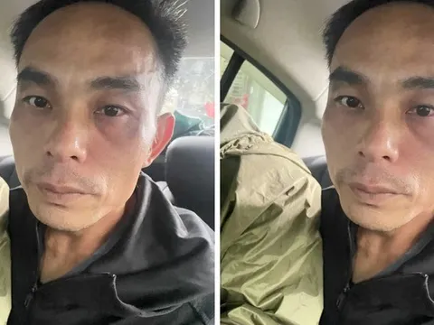 Bắt Bùi Văn Huynh, đối tượng cướp xe máy của hai chị em gái trong đêm, đẩy bé gái 5 tuổi ngã xuống đường rồi bỏ chạy