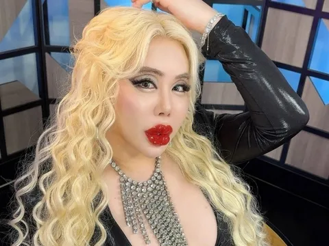 Bị bắt nạt từ nhỏ, chàng trai chi hơn 17 tỷ đồng để biến thành "người đẹp nhất thế giới”