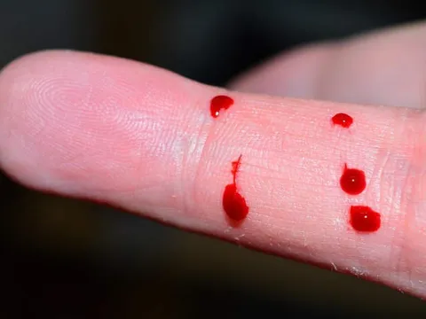 Tin clip trên mạng, nam sinh 17 tuổi tự rút máu chính mình để... uống và cái kết đắng ngắt