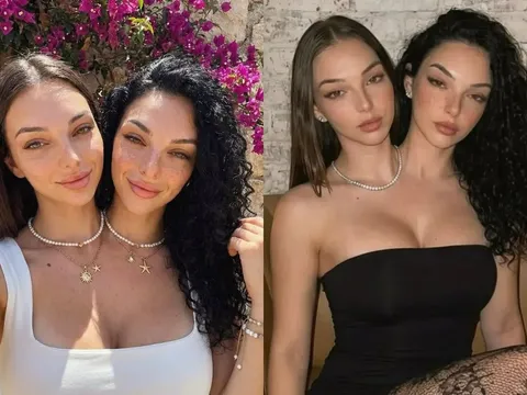 Hé lộ sự thật về cô gái 2 đầu gây sốt MXH